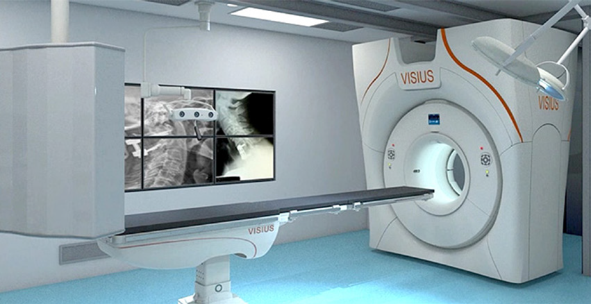 Intraoperative MRI (IMRIS Neuro III-SV)